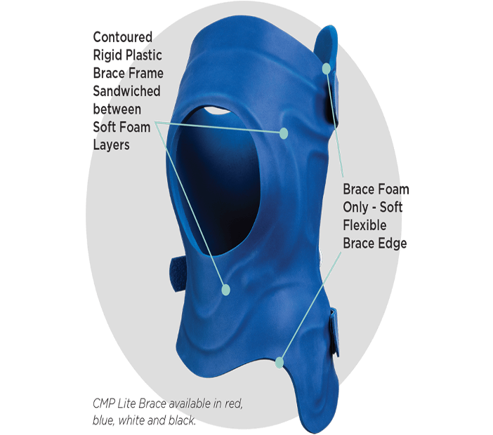 CMP rigid scoliosis brace with labelled foam and plastic frame layers